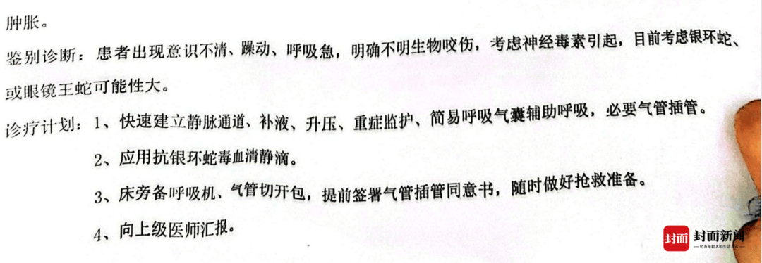三亚女游客事件抢救记录曝光：判断银环蛇或眼镜王蛇咬伤，用抗银环蛇毒血清抢救